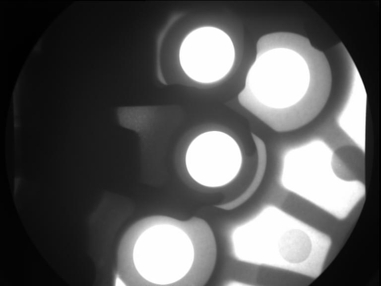 X-rays of aluminum castings